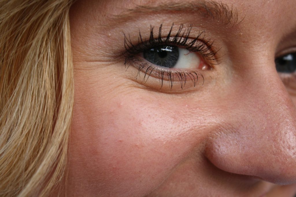 RF Skin Tightening Machines an Anti-Aging Miracle