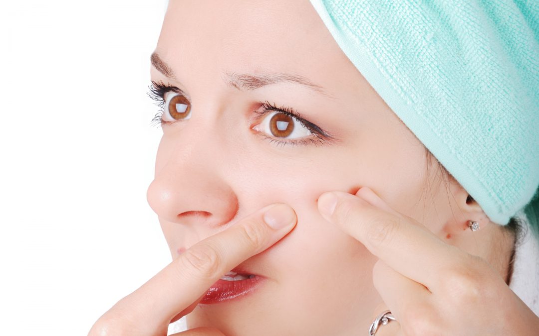 Best Acne Skin Care Routine, For the Occasional Breakout